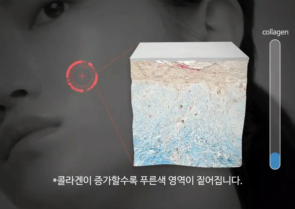 [주름리프팅] 퍼셀 82% 하이-도즈 펩타이드 콜라겐 앰플 20ml 상세페이지 10